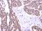 Serine/Threonine Kinase 31 antibody, NBP2-19305, Novus Biologicals, Immunohistochemistry paraffin image 