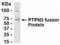 Protein Tyrosine Phosphatase Non-Receptor Type 3 antibody, XW-7831, ProSci, Western Blot image 