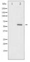 AKT Serine/Threonine Kinase 2 antibody, LS-C416640, Lifespan Biosciences, Western Blot image 