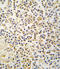 Aldehyde Dehydrogenase 1 Family Member A3 antibody, LS-C97464, Lifespan Biosciences, Immunohistochemistry frozen image 