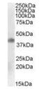 Meis Homeobox 1 antibody, orb20103, Biorbyt, Western Blot image 