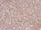 Fermitin Family Member 2 antibody, NBP2-17059, Novus Biologicals, Immunohistochemistry frozen image 