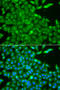 Casein Kinase 1 Gamma 2 antibody, STJ29465, St John