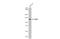 Poly(ADP-Ribose) Polymerase 1 antibody, GTX636804, GeneTex, Western Blot image 