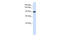 DNA repair and recombination protein RAD54B antibody, 25-355, ProSci, Enzyme Linked Immunosorbent Assay image 