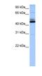 Transmembrane Protein 266 antibody, NBP1-79518, Novus Biologicals, Western Blot image 