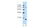 Solute Carrier Family 38 Member 4 antibody, 29-766, ProSci, Western Blot image 