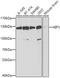 Huntingtin Interacting Protein 1 antibody, A6921, ABclonal Technology, Western Blot image 