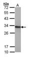High Mobility Group Box 1 antibody, GTX112959, GeneTex, Western Blot image 