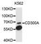 CD300a Molecule antibody, STJ112046, St John