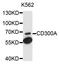 CMRF35-like molecule 8 antibody, STJ112046, St John