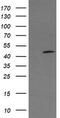 Ciliogenesis Associated TTC17 Interacting Protein antibody, CF505503, Origene, Western Blot image 