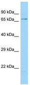 Thimet Oligopeptidase 1 antibody, TA334392, Origene, Western Blot image 