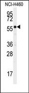 Cytochrome P450 Family 21 Subfamily A Member 2 antibody, AP14730PU-N, Origene, Western Blot image 