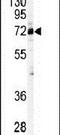 Cleavage Stimulation Factor Subunit 2 antibody, PA5-11777, Invitrogen Antibodies, Western Blot image 