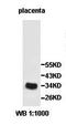 Oxidoreductase NAD Binding Domain Containing 1 antibody, orb77815, Biorbyt, Western Blot image 