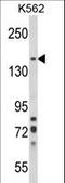 Sortilin Related VPS10 Domain Containing Receptor 1 antibody, LS-C161389, Lifespan Biosciences, Western Blot image 