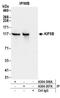 Kinesin Family Member 5B antibody, A304-307A, Bethyl Labs, Immunoprecipitation image 