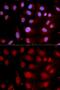 DNA Polymerase Beta antibody, GTX55594, GeneTex, Immunofluorescence image 