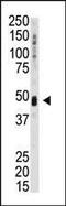 Serine/threonine-protein kinase Kist antibody, PA5-15329, Invitrogen Antibodies, Western Blot image 