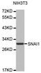 Snail Family Transcriptional Repressor 1 antibody, TA332751, Origene, Western Blot image 