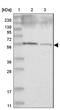 BEN Domain Containing 4 antibody, NBP1-88163, Novus Biologicals, Western Blot image 