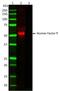 Complement Factor Properdin antibody, NB100-64749, Novus Biologicals, Western Blot image 