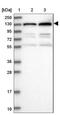 Protein Kinase N2 antibody, NBP2-13766, Novus Biologicals, Western Blot image 