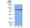 Plakophilin 1 antibody, orb386128, Biorbyt, Western Blot image 