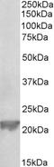 Glutathione peroxidase 1 antibody, EB11665, Everest Biotech, Western Blot image 