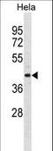 ARH1 antibody, LS-C157537, Lifespan Biosciences, Western Blot image 