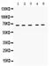 Keratin 1 antibody, PA5-79572, Invitrogen Antibodies, Western Blot image 