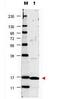 Catalase antibody, orb344951, Biorbyt, Western Blot image 