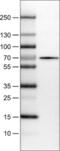 ACSB antibody, NBP2-14788, Novus Biologicals, Western Blot image 