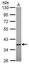 Annexin A8 antibody, PA5-31479, Invitrogen Antibodies, Western Blot image 
