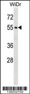 Nucleoporin 50 antibody, 58-676, ProSci, Western Blot image 