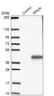 RPA Interacting Protein antibody, HPA031526, Atlas Antibodies, Western Blot image 