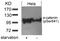 Catenin Alpha 1 antibody, 79-503, ProSci, Western Blot image 
