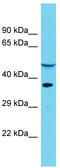 tRNA-dihydrouridine synthase 4-like antibody, TA331553, Origene, Western Blot image 