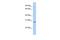 U2 small nuclear ribonucleoprotein A antibody, GTX47384, GeneTex, Western Blot image 