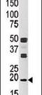 NME/NM23 Nucleoside Diphosphate Kinase 3 antibody, PA5-13957, Invitrogen Antibodies, Western Blot image 