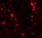 Protein numb homolog antibody, A01206, Boster Biological Technology, Immunofluorescence image 