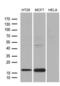 Anterior Gradient 2, Protein Disulphide Isomerase Family Member antibody, LS-C795320, Lifespan Biosciences, Western Blot image 