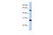 Family With Sequence Similarity 83 Member F antibody, 26-662, ProSci, Western Blot image 