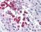 Ta1 antibody, NBP2-24720, Novus Biologicals, Immunohistochemistry paraffin image 