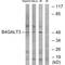 Beta-1,4-Galactosyltransferase 3 antibody, A09618, Boster Biological Technology, Western Blot image 