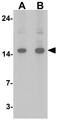 Fragile Histidine Triad Diadenosine Triphosphatase antibody, GTX31890, GeneTex, Western Blot image 