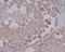 Nanog Homeobox antibody, M00153, Boster Biological Technology, Immunohistochemistry paraffin image 