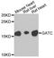 Glutamyl-TRNA Amidotransferase Subunit C antibody, A8604, ABclonal Technology, Western Blot image 