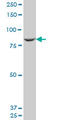 Mannosidase Alpha Class 1B Member 1 antibody, LS-C105112, Lifespan Biosciences, Western Blot image 